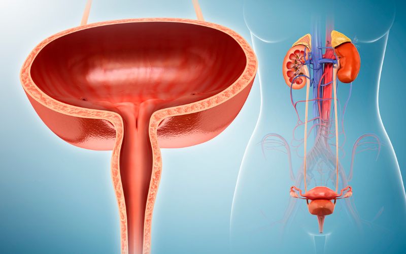 Causes of Interstitial Cystitis