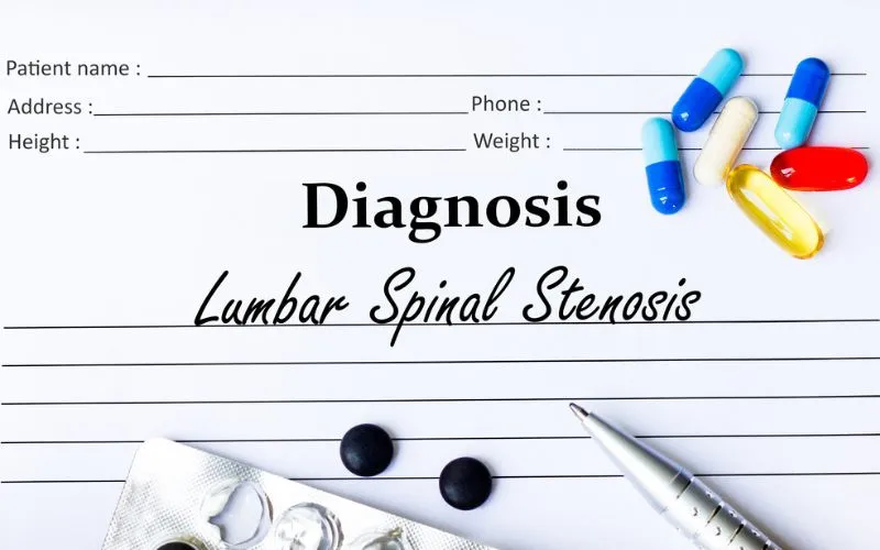 How To Diagnose And Treat Lumbar Spinal Stenosis?