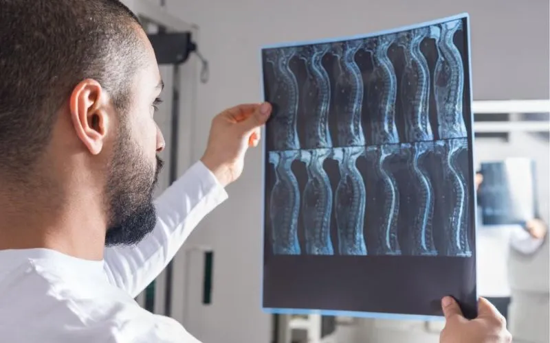 Diagnosis and Treatment of Spinal Cord Injury